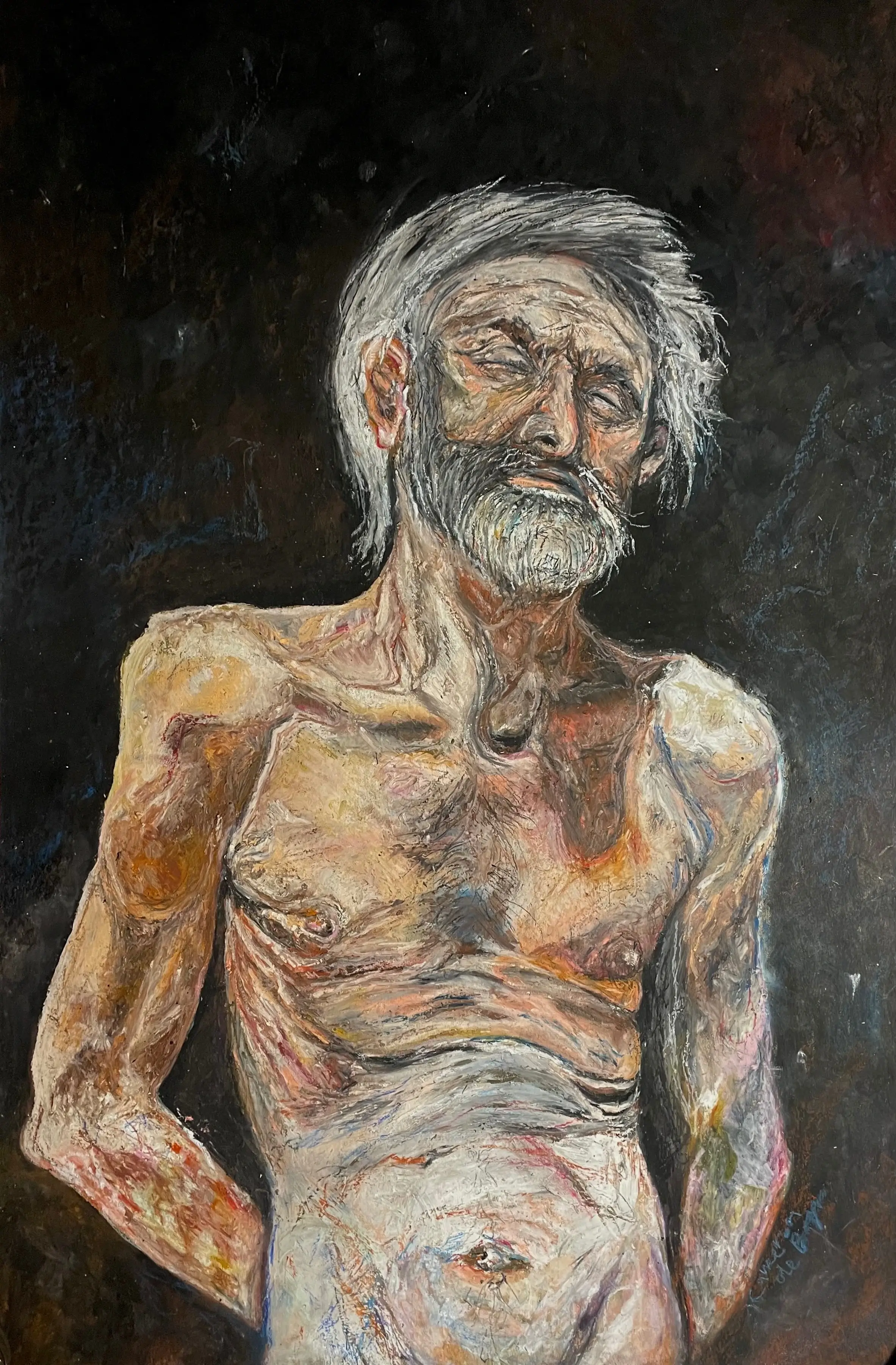 Oedipus